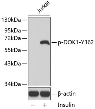 Western blot - Phospho-DOK1-Y362 pAb 
