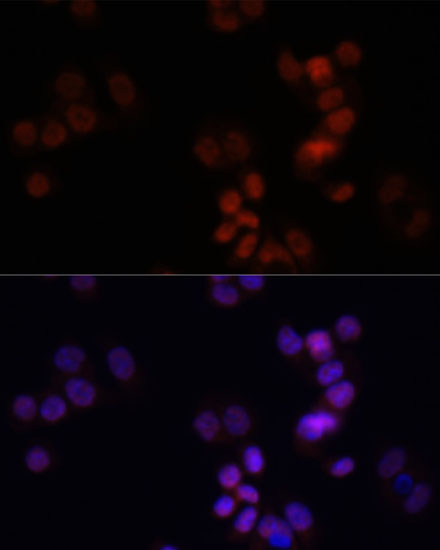 Immunofluorescence - KDM7A Polyclonal Antibody 