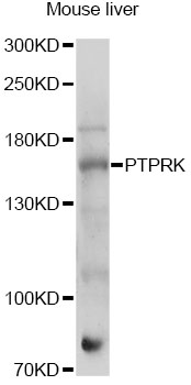 Western blot - PTPRK Polyclonal Antibody 