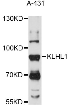 Western blot - KLHL1 Polyclonal Antibody 