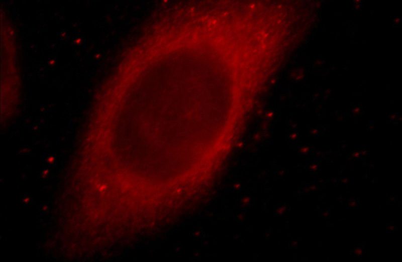 Immunofluorescent analysis of HepG2 cells, using MYO7A antibody Catalog No:112986 at 1:25 dilution and Rhodamine-labeled goat anti-rabbit IgG (red).