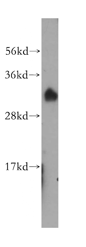 mouse testis tissue were subjected to SDS PAGE followed by western blot with Catalog No:107854(AIG1 antibody) at dilution of 1:400