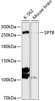 Western blot - SPTB Polyclonal Antibody 