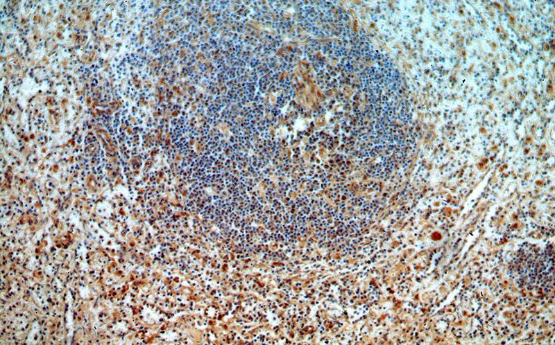 Immunohistochemical of paraffin-embedded human spleen using Catalog No:116084(TMCO6 antibody) at dilution of 1:100 (under 10x lens)