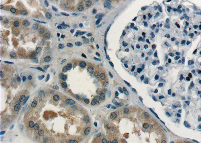Immunohistochemistry of paraffin-embedded human kidney tissue slide using Catalog No:114615(RBM46 Antibody) at dilution of 1:50 (under 40x lens)