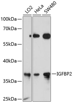 Western blot - IGFBP2 Polyclonal Antibody 