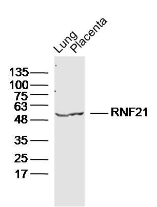 Fig1: Sample:; Lung (Mouse) Lysate at 40 ug; Placenta (Mouse) Lysate at 40 ug; Primary: Anti-RNF21 at 1/300 dilution; Secondary: IRDye800CW Goat Anti-Rabbit IgG at 1/20000 dilution; Predicted band size: 57kD; Observed band size: 55kD