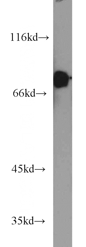 Jurkat cells were subjected to SDS PAGE followed by western blot with Catalog No:108265(ARHGAP25 antibody) at dilution of 1:1200