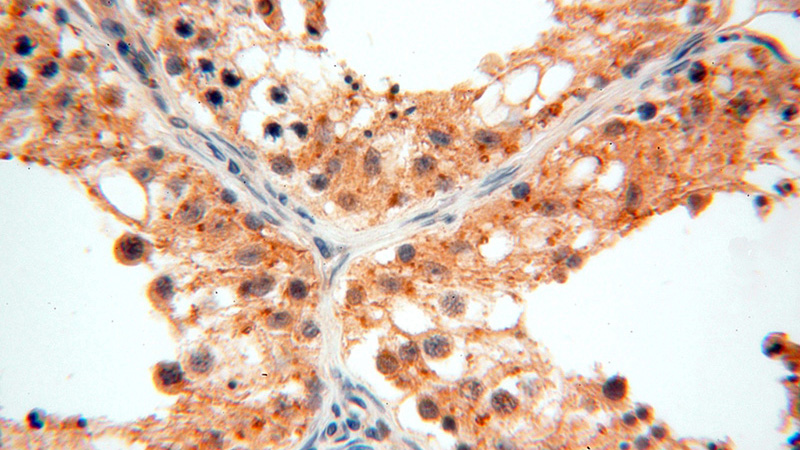 Immunohistochemical of paraffin-embedded human testis using Catalog No:111226(GTDC1 antibody) at dilution of 1:100 (under 40x lens)