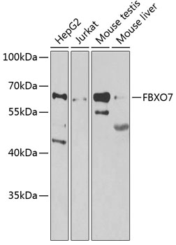 Western blot - FBXO7 Polyclonal Antibody 