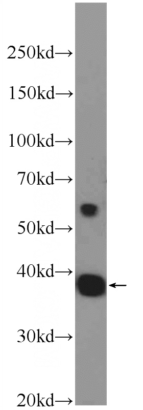 C6 cells were subjected to SDS PAGE followed by western blot with Catalog No:111305(HEXIM2 Antibody) at dilution of 1:600