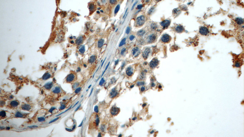 Immunohistochemistry of paraffin-embedded human testis tissue slide using Catalog No:113327(ODF3 Antibody) at dilution of 1:50 (under 40x lens)