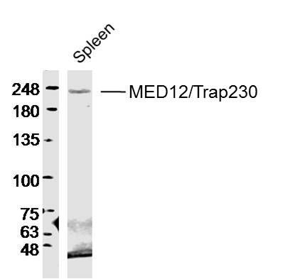 Fig2: Sample: Spleen (Mouse) Lysate at 40 ug; Primary: Anti- MED12/Trap230 at 1/300 dilution; Secondary: IRDye800CW Goat Anti-Rabbit IgG at 1/20000 dilution; Predicted band size: 243kD; Observed band size: 243kD