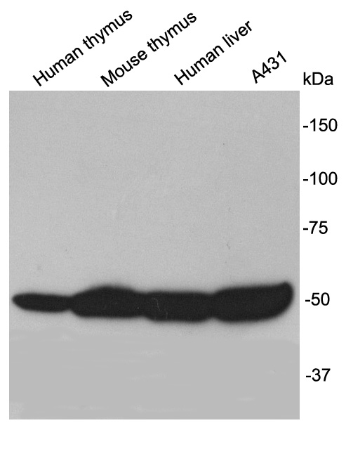 Fig1: Western blot analysis of TESPA1 on different lysates using anti-TESPA1 antibody at 1/1,000 dilution.