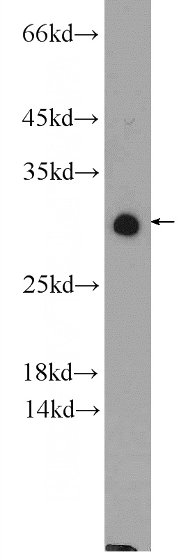 HeLa cells were subjected to SDS PAGE followed by western blot with Catalog No:113382(NUP62CL Antibody) at dilution of 1:600