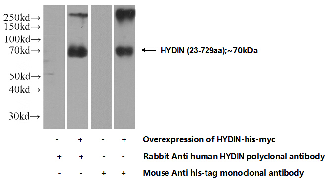 Transfected HEK-293 cells were subjected to SDS PAGE followed by western blot with Catalog No:111579(HYDIN Antibody) at dilution of 1:1000