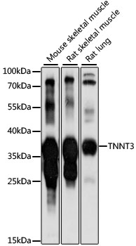Western blot - TNNT3 Polyclonal Antibody 
