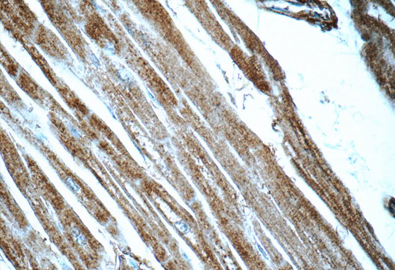 Immunohistochemistry of paraffin-embedded human heart tissue slide using Catalog No:112093(KLHL14-Specific Antibody) at dilution of 1:50 (under 40x lens)