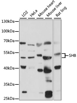 Western blot - SHB Polyclonal Antibody 