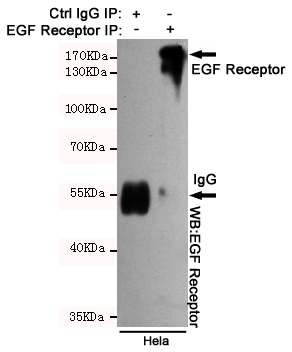 Immunoprecipitation analysis of Hela cell lysates using EGFR mouse mAb.