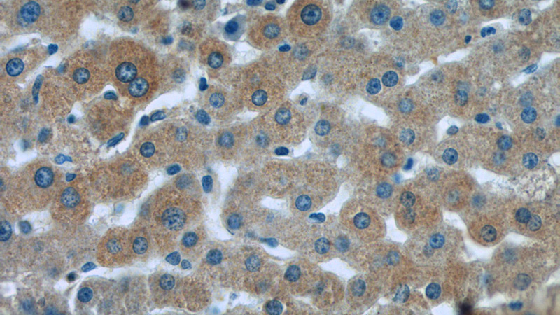 Immunohistochemistry of paraffin-embedded human liver tissue slide using Catalog No:114553(RAPH1 Antibody) at dilution of 1:50 (under 40x lens)