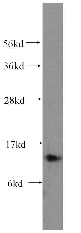 human heart tissue were subjected to SDS PAGE followed by western blot with Catalog No:114966(S100A9 antibody) at dilution of 1:500