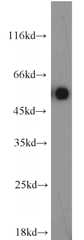 mouse testis tissue were subjected to SDS PAGE followed by western blot with Catalog No:112252(LMBR1L antibody) at dilution of 1:600