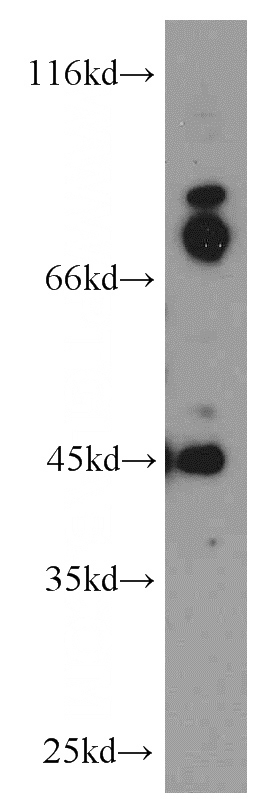 HepG2 cells were subjected to SDS PAGE followed by western blot with Catalog No:111059(GPBP1 antibody) at dilution of 1:500