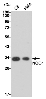 Western blot analysis of extracts from MCF7 and Hela cell lysates using NQO1 mouse mAb (1:1000 diluted).Predicted band size:31KDa.Observed band size:31KDa.