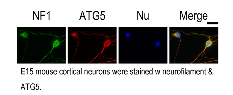 IF result of anti-ATG5 (Catalog No:108299) with E15 mouse cortical neurons.