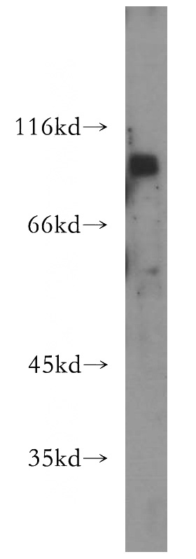 MCF7 cells were subjected to SDS PAGE followed by western blot with Catalog No:111810(INTS8 antibody) at dilution of 1:300
