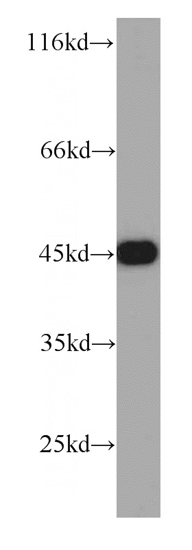 HeLa cells were subjected to SDS PAGE followed by western blot with Catalog No:109603(CSNK2A1 antibody) at dilution of 1:1000