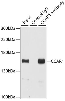 Immunoprecipitation - CCAR1 Polyclonal Antibody 
