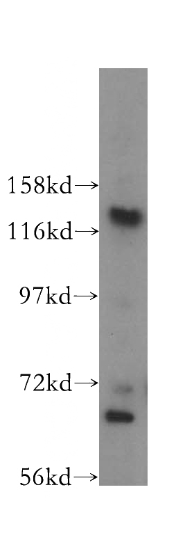 A431 cells were subjected to SDS PAGE followed by western blot with Catalog No:113296(NOL6 antibody) at dilution of 1:300