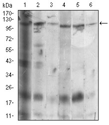 Western blot analysis using SDC1 mouse mAb against Hela (1), MCF-7 (2), HepG2 (3), T47D (4), Jurkat (5), NIH/3T3 (6) cell lysate.
