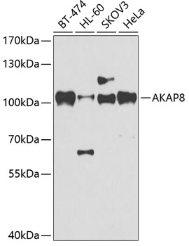 Western blot - AKAP8 Polyclonal Antibody 