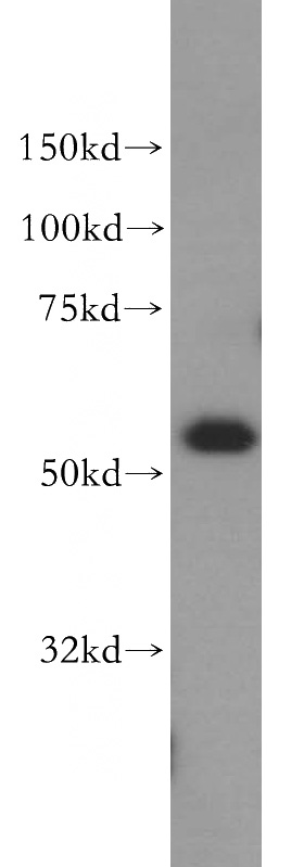 Raji cells were subjected to SDS PAGE followed by western blot with Catalog No:112353(LSP1 antibody) at dilution of 1:500