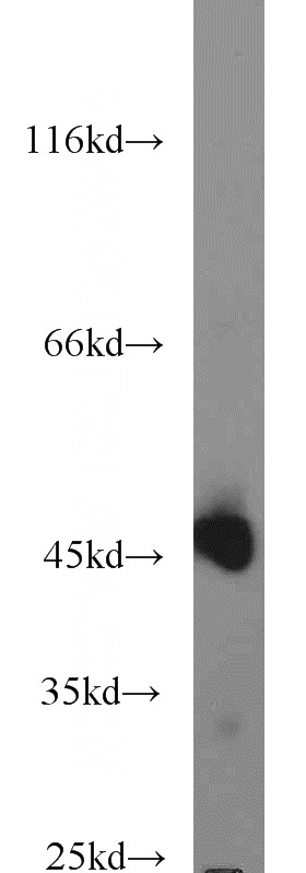 HepG2 cells were subjected to SDS PAGE followed by western blot with Catalog No:108799(C9orf41 antibody) at dilution of 1:1000