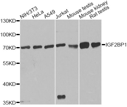 Western blot - IGF2BP1 Polyclonal Antibody 