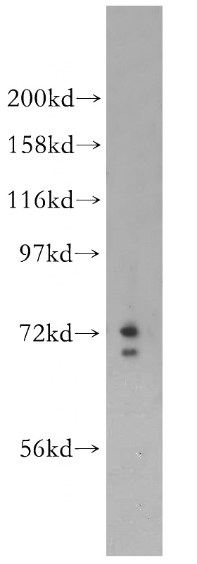 A375 cells were subjected to SDS PAGE followed by western blot with Catalog No:108971(CCDC28A antibody) at dilution of 1:300