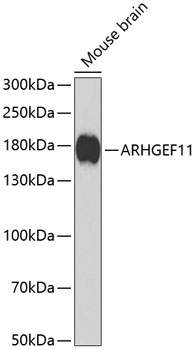 Western blot - ARHGEF11 Polyclonal Antibody 