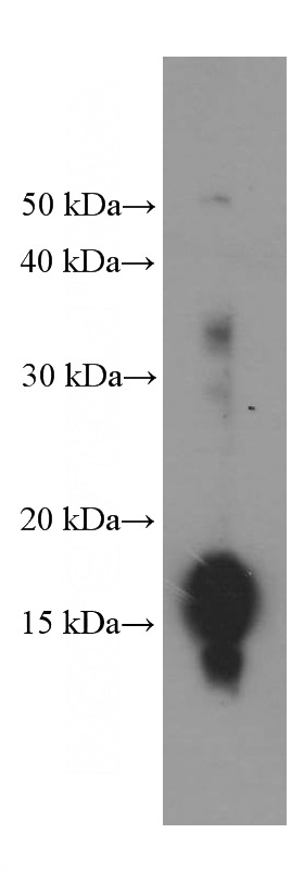 HeLa cells were subjected to SDS PAGE followed by western blot with Catalog No:107451(Pan Acetylation Antibody) at dilution of 1:1500