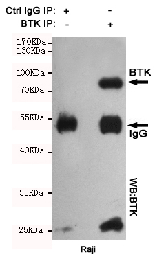 Immunoprecipitation analysis of Raji cell lysates using BTK mouse mAb.