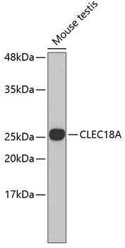 Western blot - CLEC18A Polyclonal Antibody 