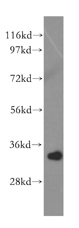 HepG2 cells were subjected to SDS PAGE followed by western blot with Catalog No:114897(RPL5 antibody) at dilution of 1:500