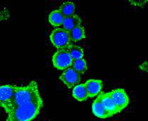 Fig2: Immunocytochemical staining of SW480 cells using anti-BMP11 rabbit polyclonal antibody.