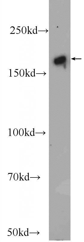 Jurkat cells were subjected to SDS PAGE followed by western blot with Catalog No:110939(GEMIN5 Antibody) at dilution of 1:1500