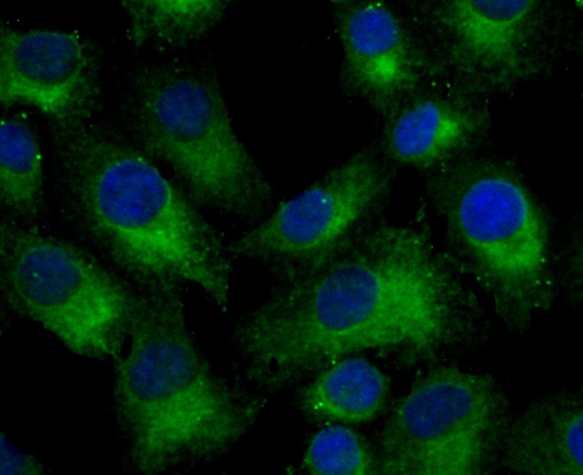 Fig3:; ICC staining of Nogo in A549 cells (green). Formalin fixed cells were permeabilized with 0.1% Triton X-100 in TBS for 10 minutes at room temperature and blocked with 10% negative goat serum for 15 minutes at room temperature. Cells were probed with the primary antibody ( 1/50) for 1 hour at room temperature, washed with PBS. Alexa Fluor®488 conjugate-Goat anti-Rabbit IgG was used as the secondary antibody at 1/1,000 dilution. The nuclear counter stain is DAPI (blue).