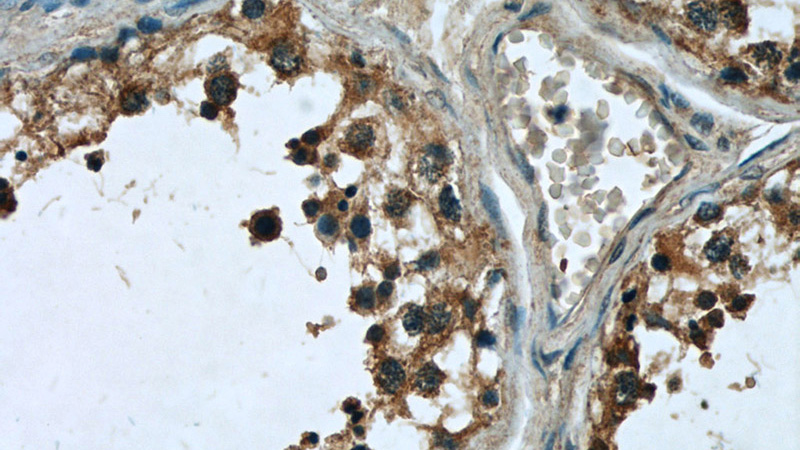 Immunohistochemistry of paraffin-embedded human testis slide using Catalog No:115994(C1orf223 Antibody) at dilution of 1:50 (under 40x lens)