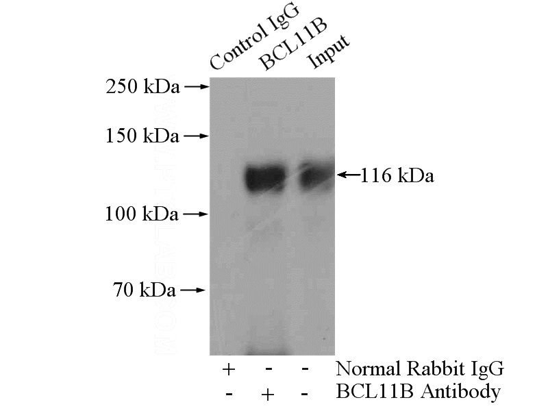 IP Result of anti-BCL11B (IP:Catalog No:108390, 4ug; Detection:Catalog No:108390 1:500) with Jurkat cells lysate 2800ug.